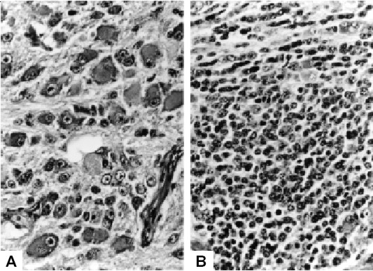 Esame istologico della massa