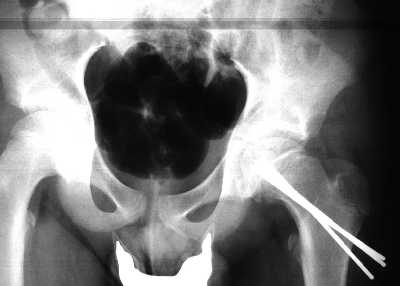 fig.1