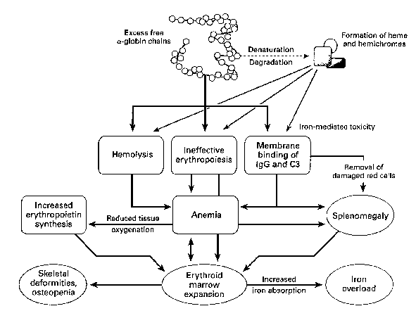 Effetti dell'eccesso di produzione delle catene a della globina