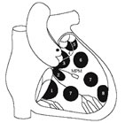 Classificazione dei DIV